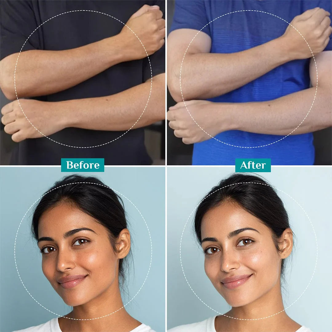 Pilgrim Peeling Solution | For Smooth-textured Glowing Skin